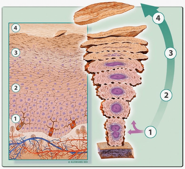 keratinization of cells in psoriasis